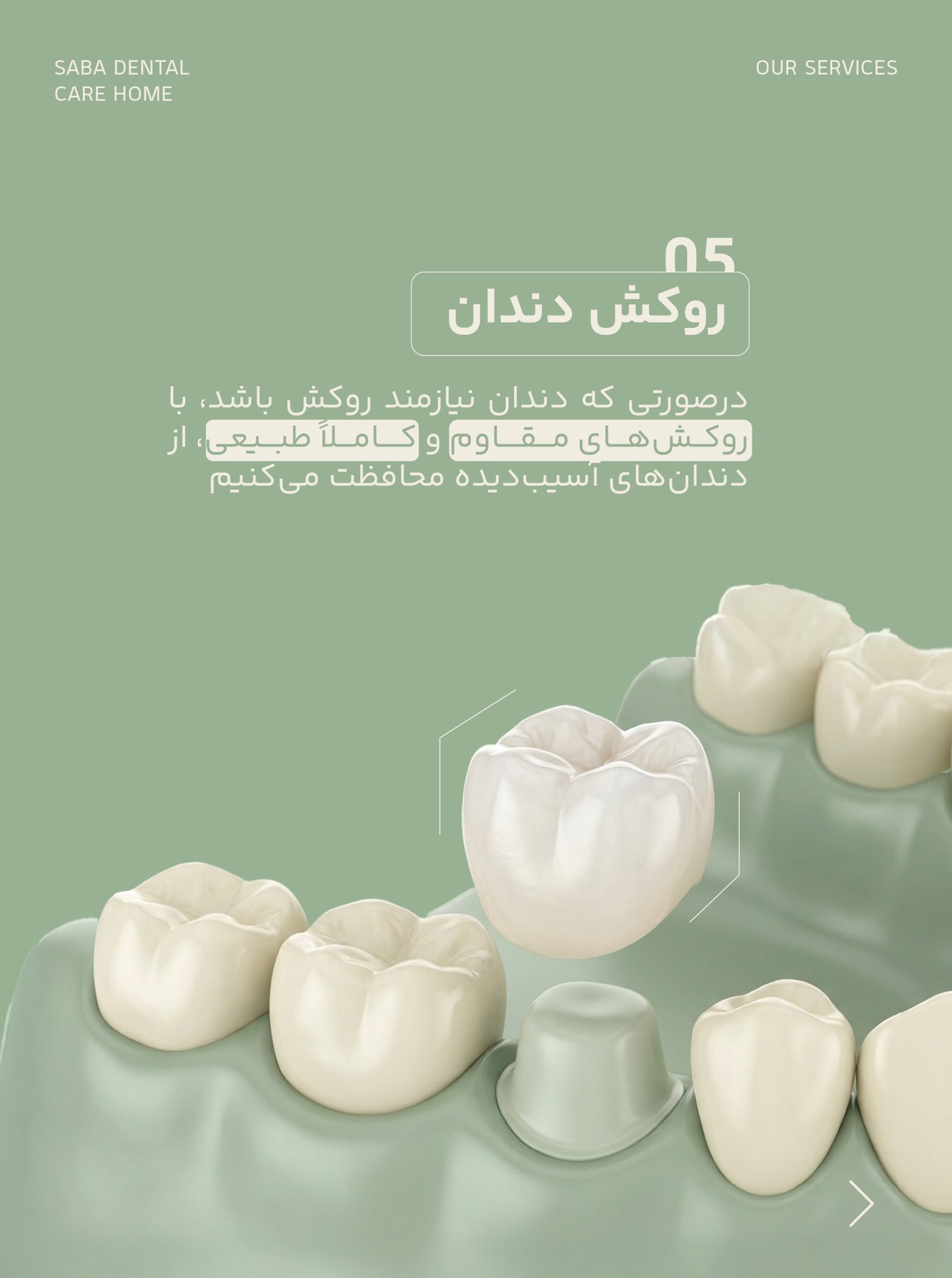 روکش و پروتز دندانی